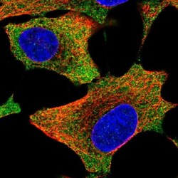 AIMP2 Antibody, Novus Biologicals 25 &mu;L; Unlabeled:Antikörper